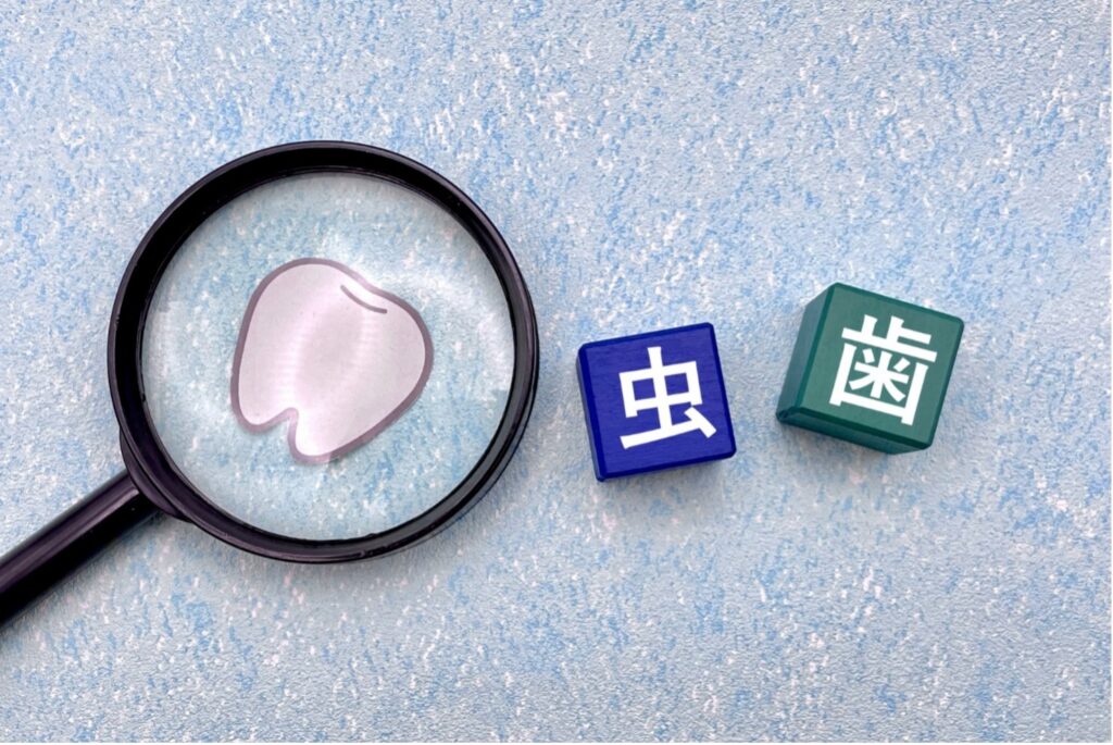 虫歯を放置することで起こる口腔内の変化