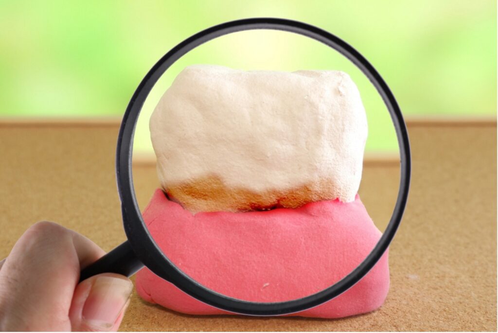 歯みがきが1日1回では不十分な理由