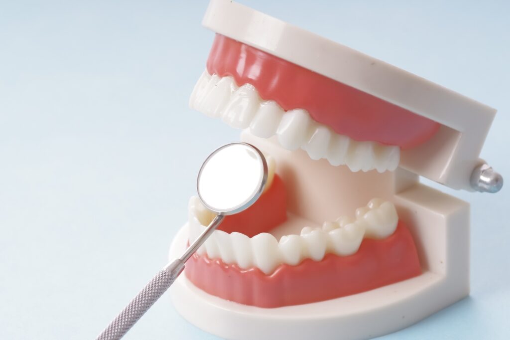 歯周病のサインを知るべき理由